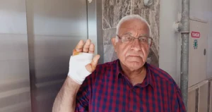 Parmak Isırma: Konyalı Yaşlı Adamın Parmağı Isırıldı!